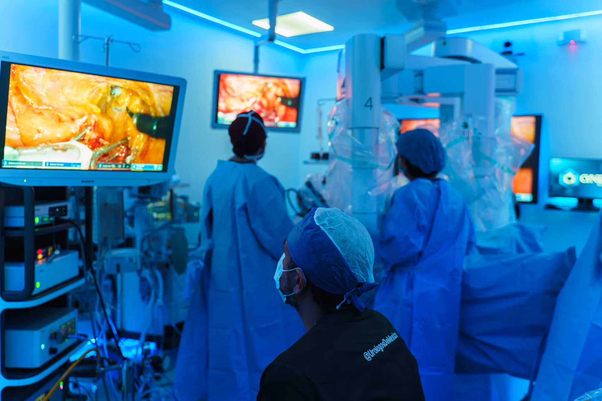 Surgical team watching live endoscopic monitors beside the sterile-draped OMNIBOT MP 1000 patient cart during a robotic procedure